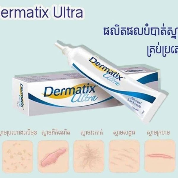 Dermatix Ultra Gel - L192