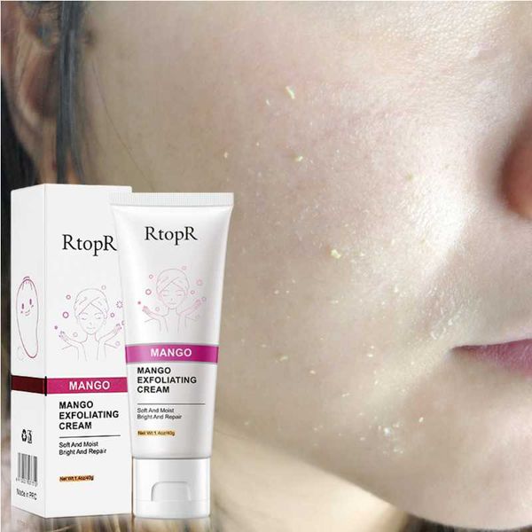 thumbnail image 2 of SuperWhite Skin Whitening Cream - Dark Spot & Freckle Remover, Vitamin E, All Skin Types (1.7 Fl Oz) 2 of 4
