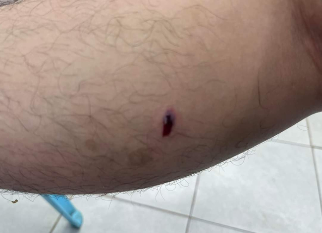 Photo Credit From Original Uploader