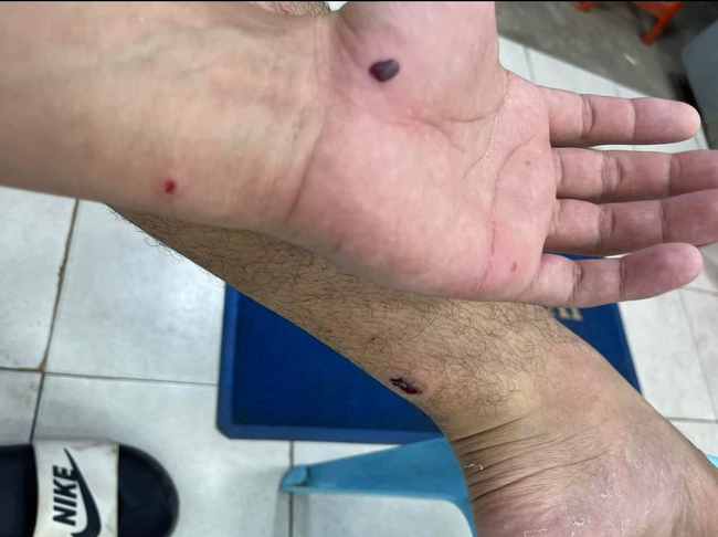 Photo Credit From Original Uploader