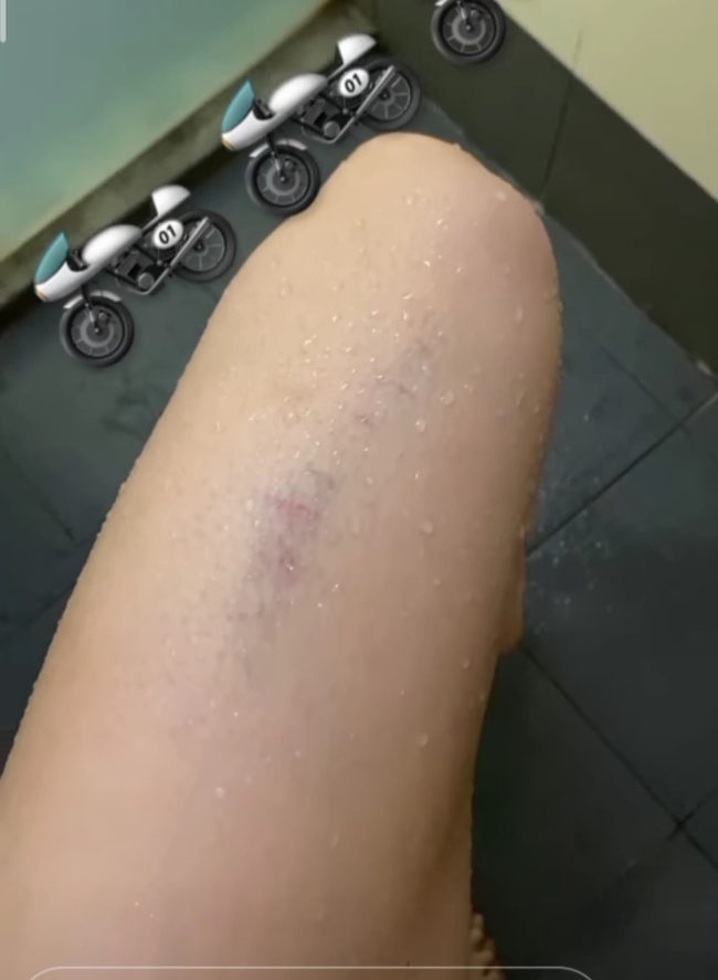 Photo Credit - Aye Myat Thu's IG Acc